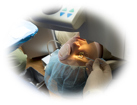 Lasik Surgery for removal of glasses